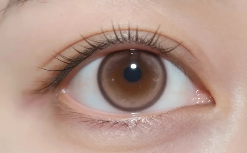 Why does my contact keep moving when I blink